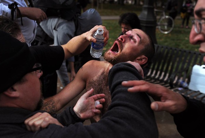 Một người biểu tình có tên Phillip Becerra bị bắn đạn hơi cay vào mặt đang được những người cũng tham gia trợ giúp ngày 29/10/2011.